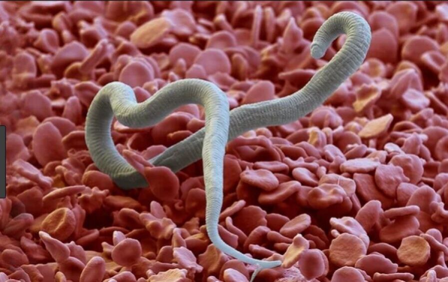 worms in the human body
