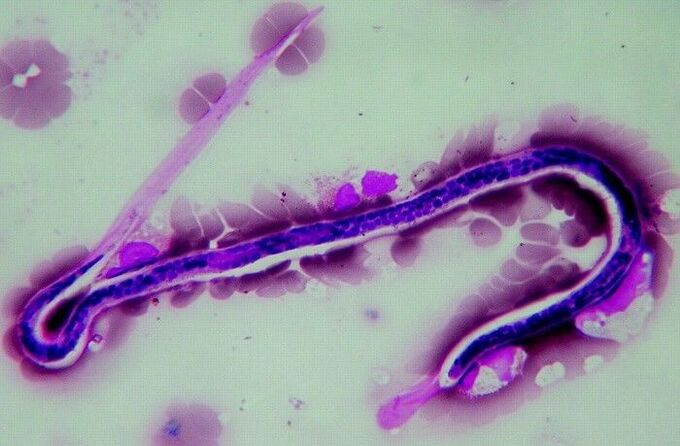 Heartworm under the microscope