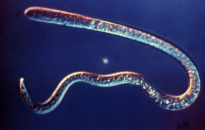 parasitic worm from the human body