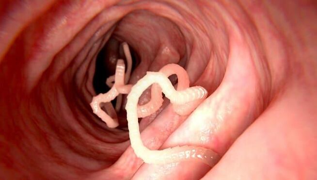 Worms that live in the human intestine