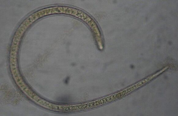 Trichinella is a protostomal round parasitic worm
