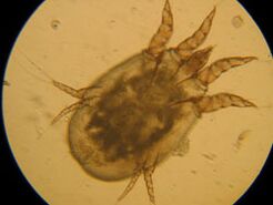 Tick ​​on the microscope